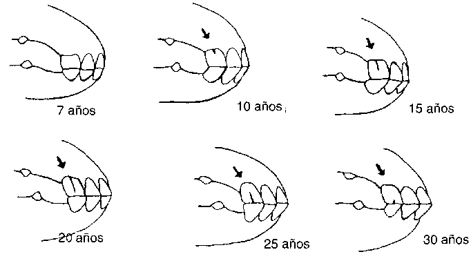 numero de dientes en un caballo y una yegua